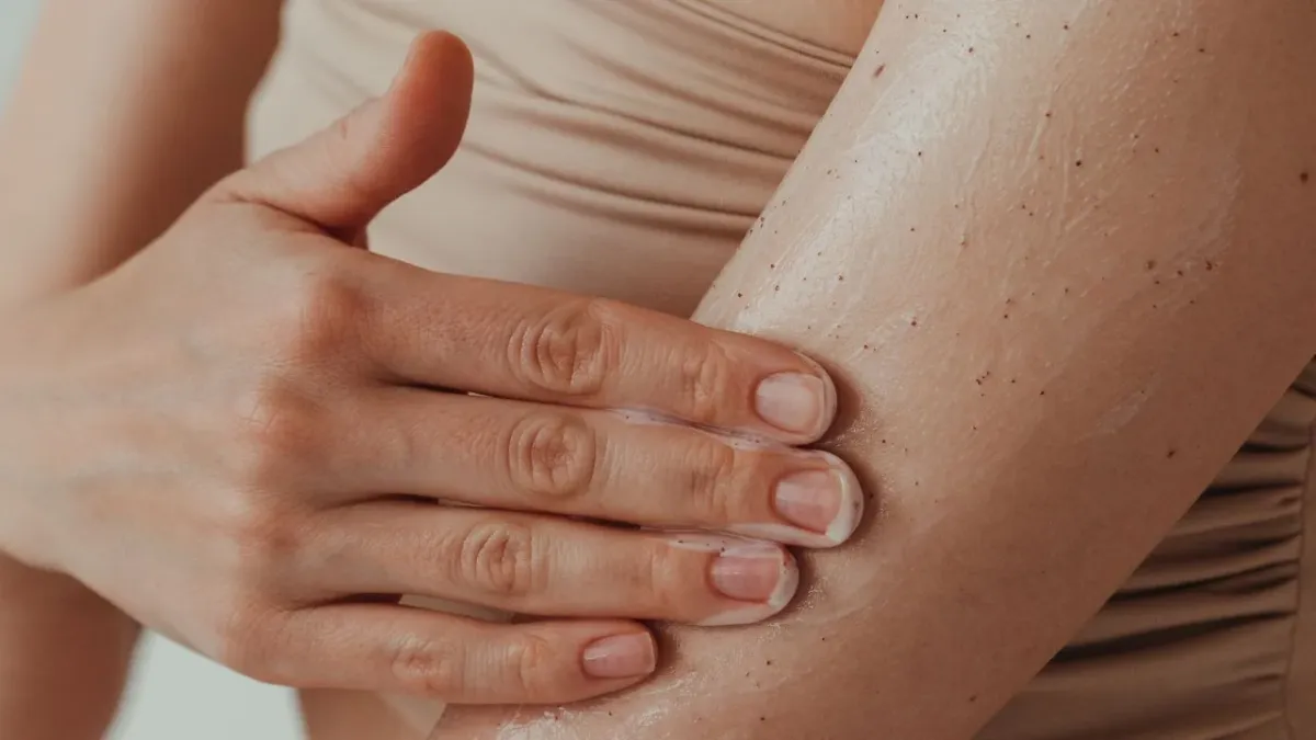 Koebnerov fenomen: Koji kozmetički proizvodi mogu izazvati pogoršanje psorijaze