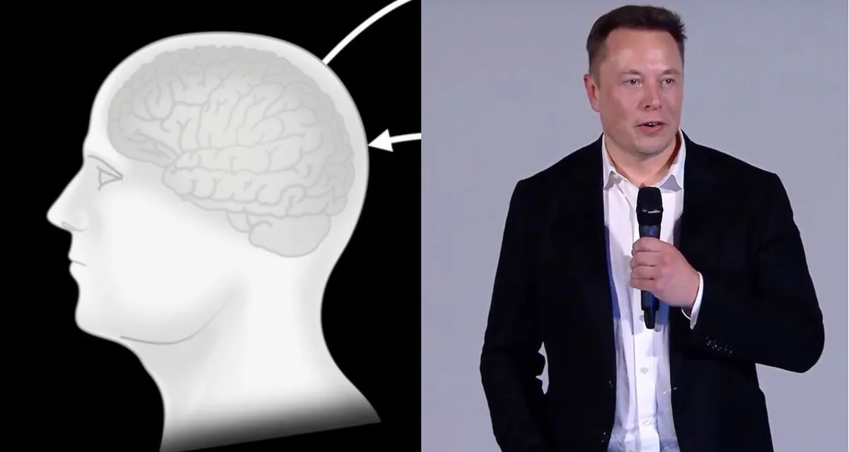 Nova nada za sve paralizirane osobe : Muskov Neuralink počinje ispitivanja na ljudima?