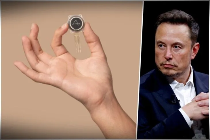 Muskov Neuralink ugradio čip u mozak čovjeka: “Prvi korisnici bit će oni koji su izgubili moć korištenja udova”