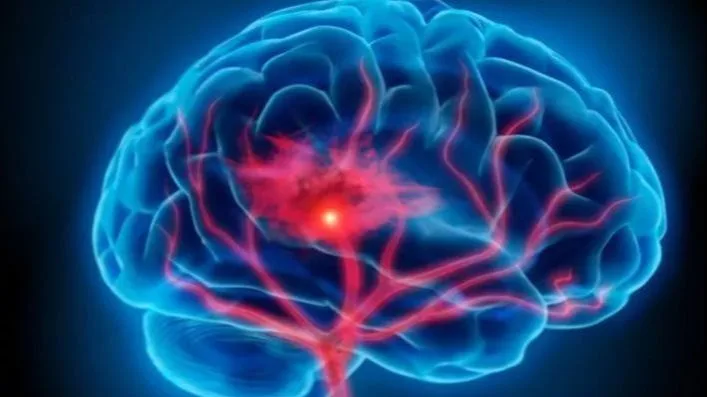 Otkrivena skrivena kombinacija koja ubrzava starenje mozga i povećava rizik od Alzheimerove bolesti
